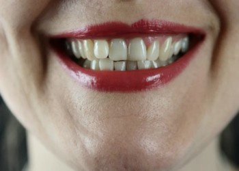  صوت الإمارات - الكشف عن دواء ثوري يمكنه إعادة نمو أسنان الإنسان من جديد